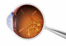 ����۵��γ�ԭ�򼰷���